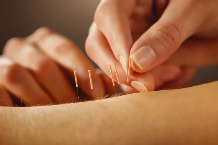 Unlocking the Healing Potential of TCM Acupuncture in Singapore